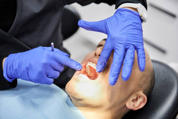 Best Emergency Treatment for Dental Infections or Abscesses in Mona, UT
